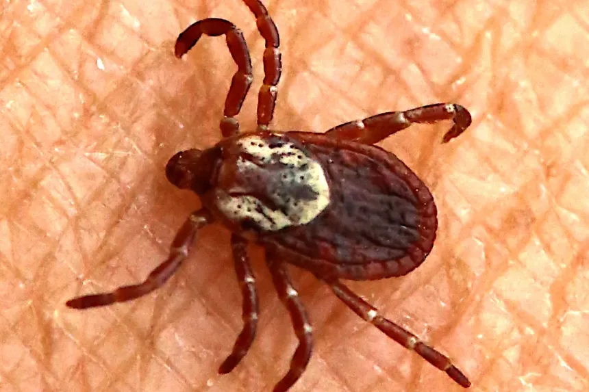 Female American dog tick, dark reddish brown with a cream-colored shield, crawling on human skin